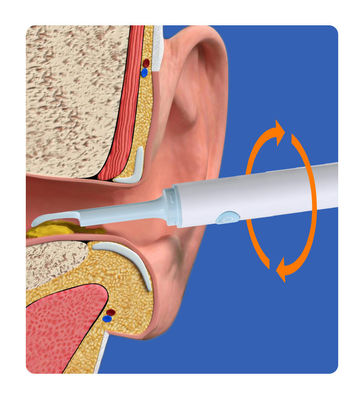 Smart Visual Ear Cleaning Rod Medizinische Kamera Endoskop für andere Haushaltschemikalien